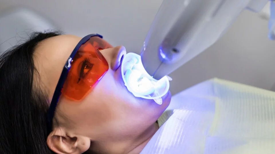 Power-Bleaching: weiße Zähne in einem Termin